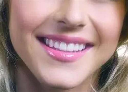 石家庄2025成人牙齿矫正收费表揭晓!(含12-18岁牙齿矫正/3-12岁牙齿矫正价格价目表)