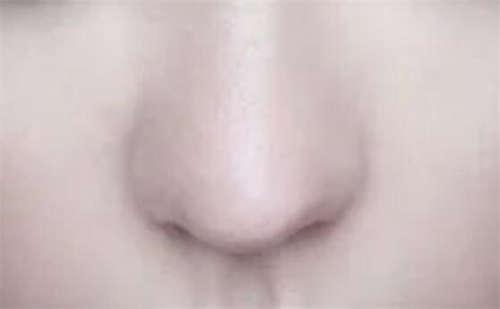 武汉地包天牙齿矫正多少钱?价格在8790-10558,下巴后缩牙齿矫正6000-50000